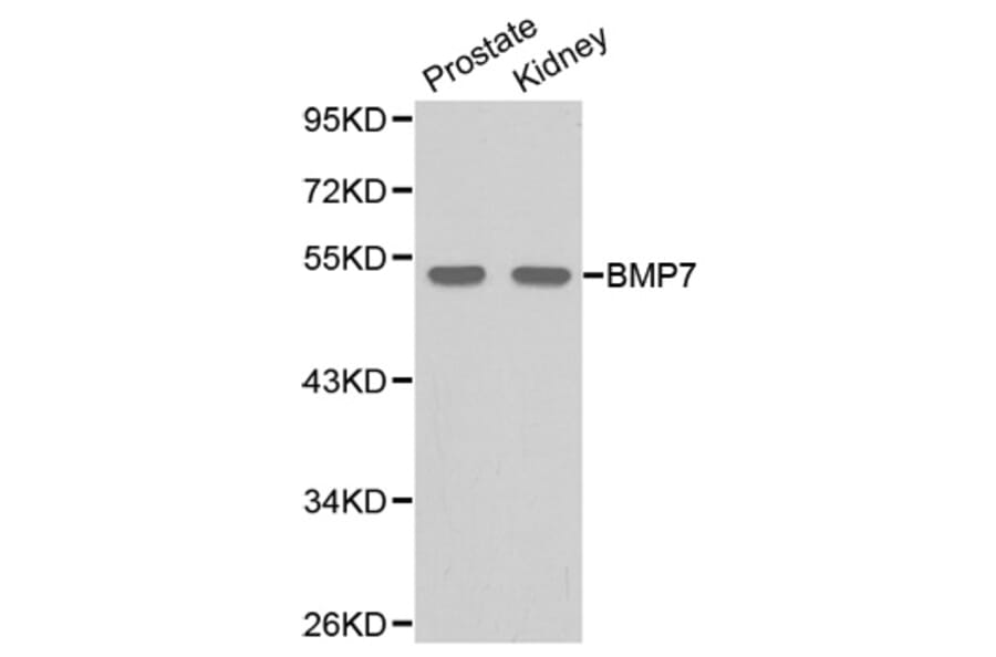 Western blot - BMP7 Antibody from Signalway Antibody (32087) - Antibodies.com