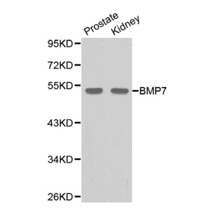 Western blot - BMP7 Antibody from Signalway Antibody (32087) - Antibodies.com