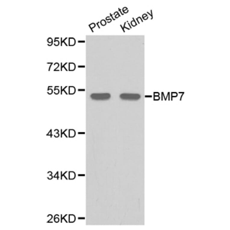 Western blot - BMP7 Antibody from Signalway Antibody (32087) - Antibodies.com