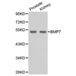 Western blot - BMP7 Antibody from Signalway Antibody (32087) - Antibodies.com