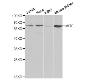 Western blot - MITF Antibody from Signalway Antibody (32260) - Antibodies.com