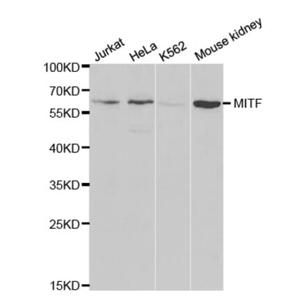 Western blot - MITF Antibody from Signalway Antibody (32260) - Antibodies.com