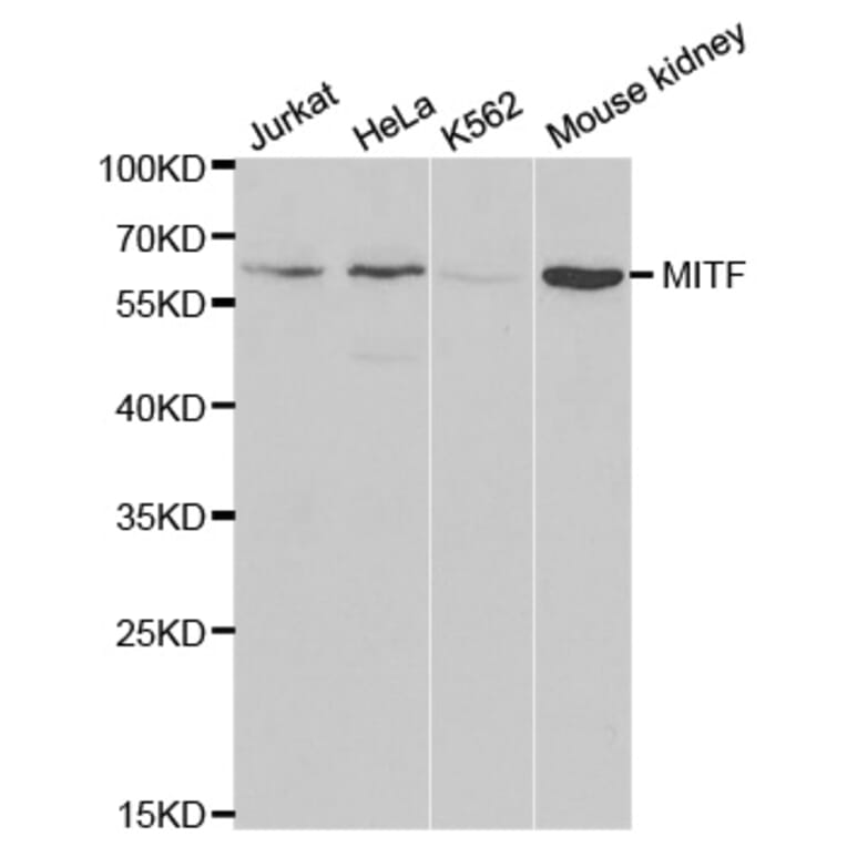 Western blot - MITF Antibody from Signalway Antibody (32260) - Antibodies.com