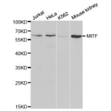 Western blot - MITF Antibody from Signalway Antibody (32260) - Antibodies.com