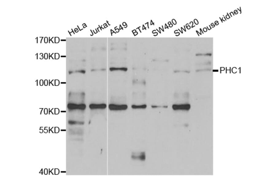 Western blot - PHC1 Antibody from Signalway Antibody (33082) - Antibodies.com