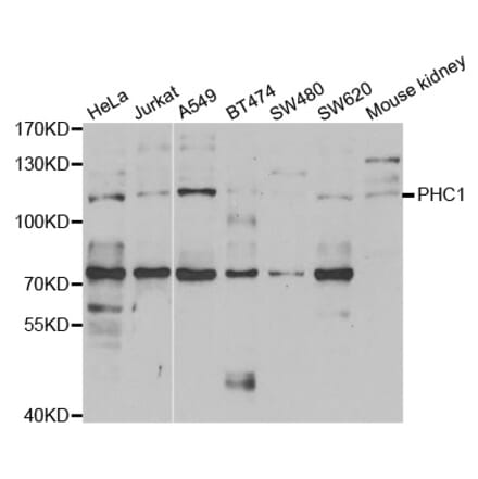 Western blot - PHC1 Antibody from Signalway Antibody (33082) - Antibodies.com
