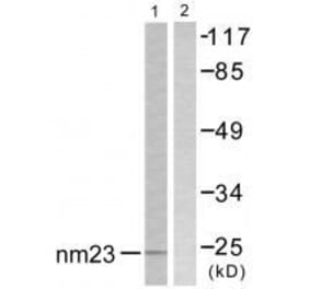 Western blot - NM23 Antibody from Signalway Antibody (33449) - Antibodies.com
