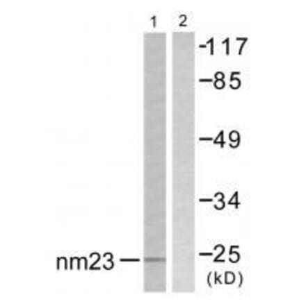 Western blot - NM23 Antibody from Signalway Antibody (33449) - Antibodies.com