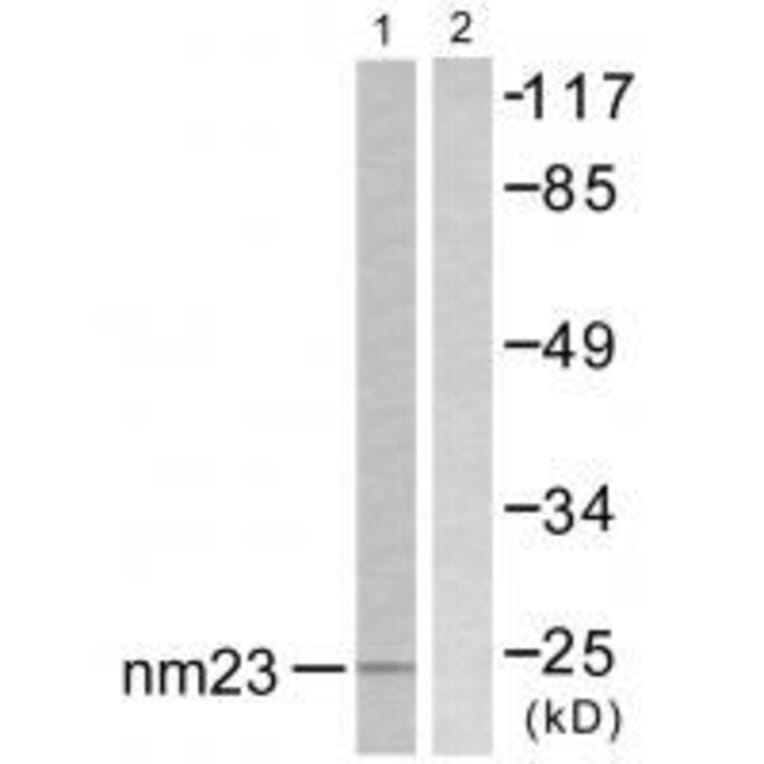 Western blot - NM23 Antibody from Signalway Antibody (33449) - Antibodies.com