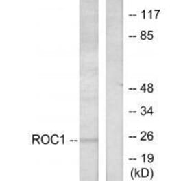 Western blot - RIT1 Antibody from Signalway Antibody (33482) - Antibodies.com