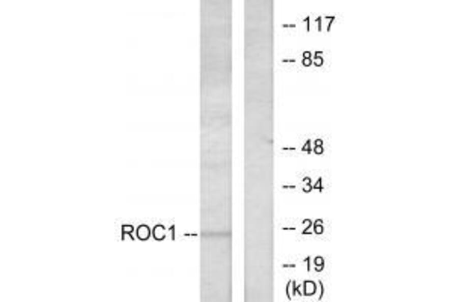 Western blot - RIT1 Antibody from Signalway Antibody (33482) - Antibodies.com