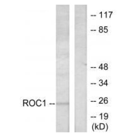 Western blot - RIT1 Antibody from Signalway Antibody (33482) - Antibodies.com