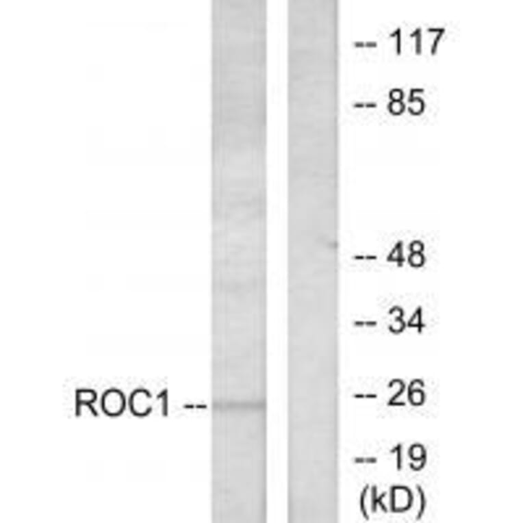 Western blot - RIT1 Antibody from Signalway Antibody (33482) - Antibodies.com