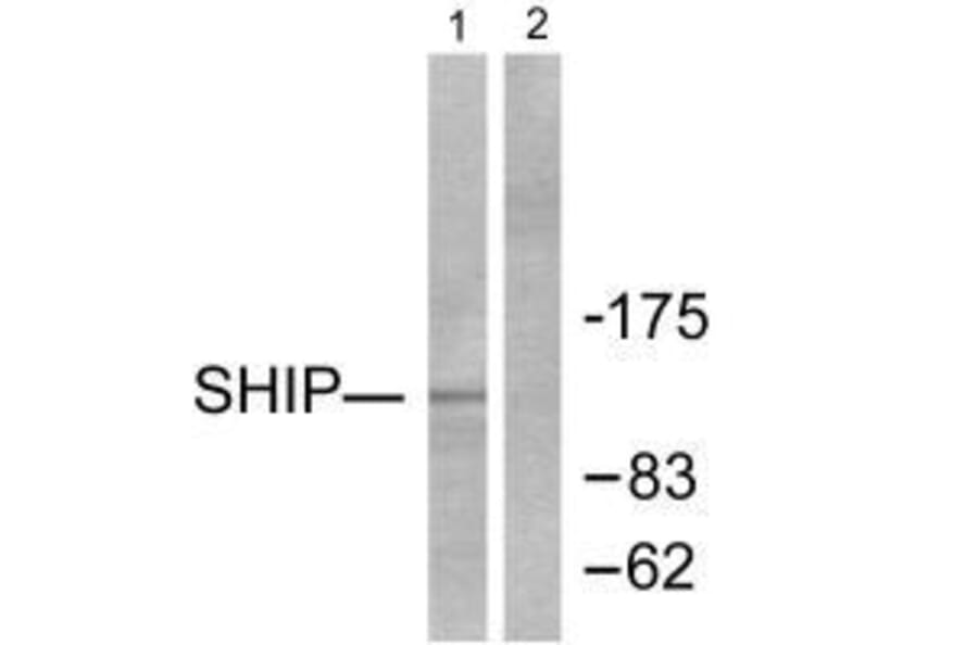 Western blot - SHIP Antibody from Signalway Antibody (33484) - Antibodies.com