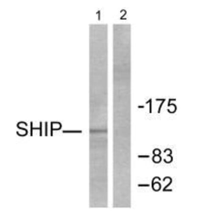 Western blot - SHIP Antibody from Signalway Antibody (33484) - Antibodies.com