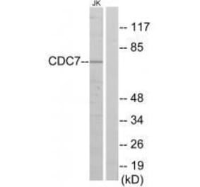 Western blot - CDC7 Antibody from Signalway Antibody (33558) - Antibodies.com