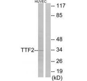 Western blot - TTF2 Antibody from Signalway Antibody (33559) - Antibodies.com