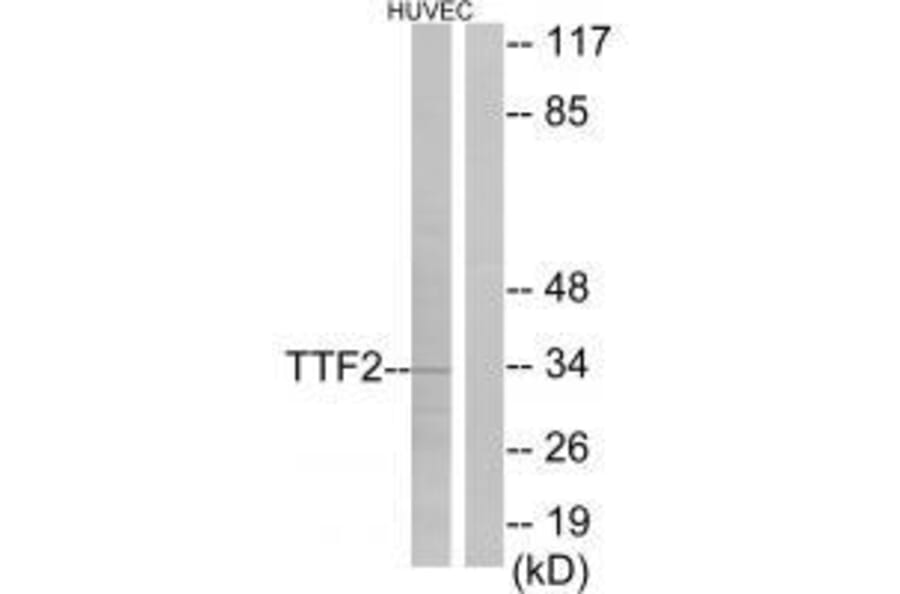 Western blot - TTF2 Antibody from Signalway Antibody (33559) - Antibodies.com
