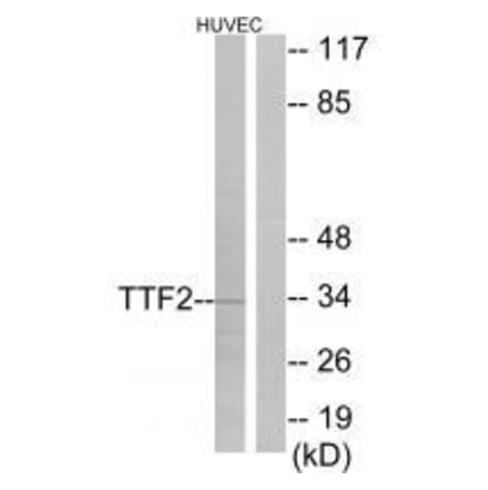 Western blot - TTF2 Antibody from Signalway Antibody (33559) - Antibodies.com