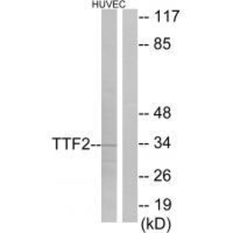Western blot - TTF2 Antibody from Signalway Antibody (33559) - Antibodies.com