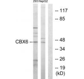 Western blot - CBX6 Antibody from Signalway Antibody (33635) - Antibodies.com
