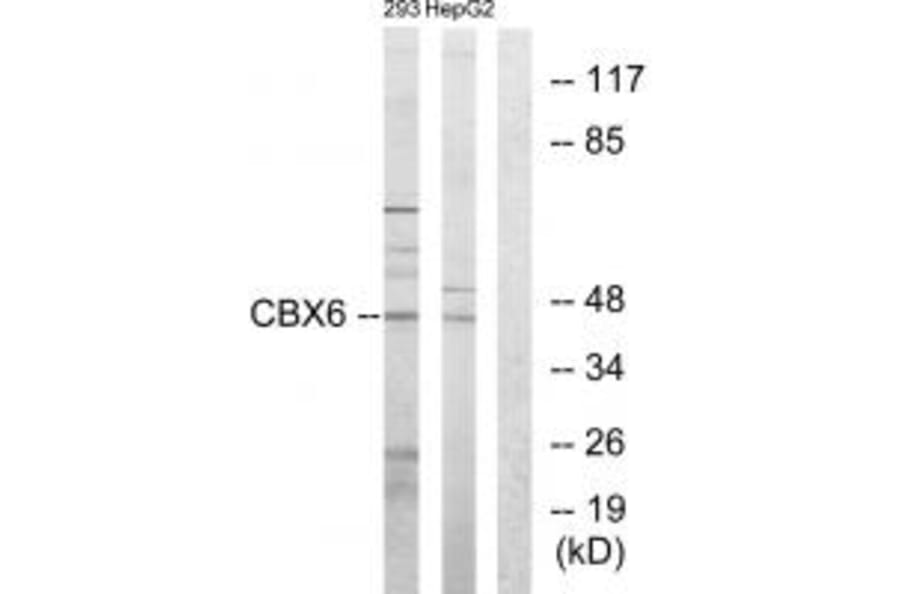 Western blot - CBX6 Antibody from Signalway Antibody (33635) - Antibodies.com