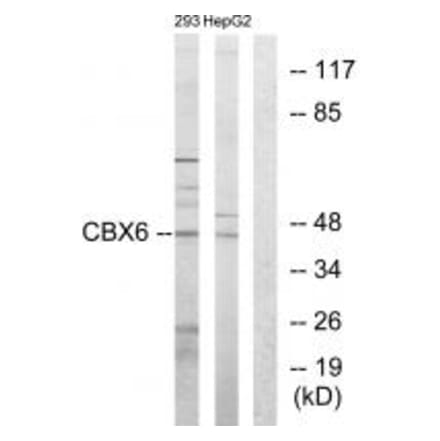 Western blot - CBX6 Antibody from Signalway Antibody (33635) - Antibodies.com
