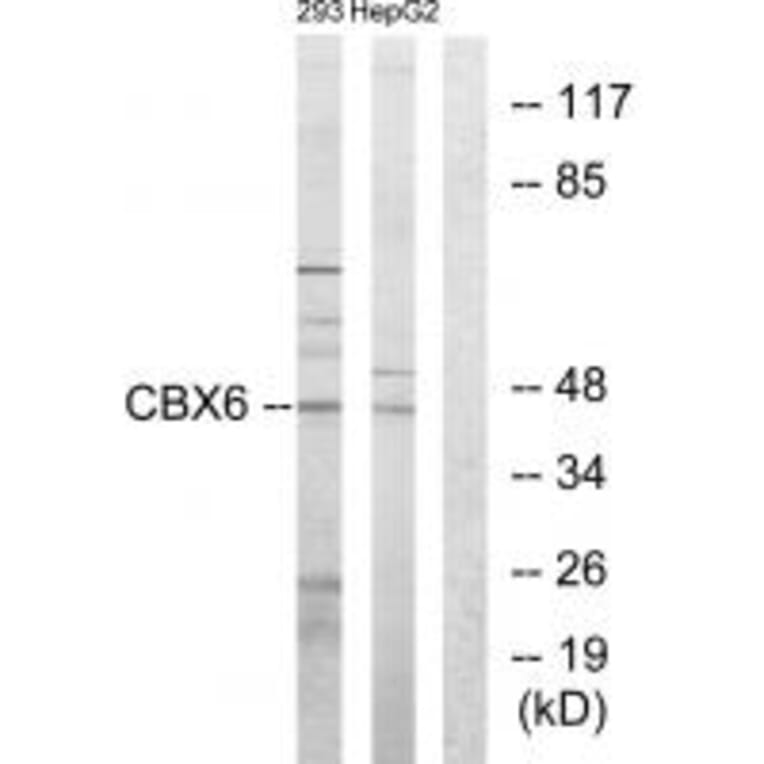 Western blot - CBX6 Antibody from Signalway Antibody (33635) - Antibodies.com