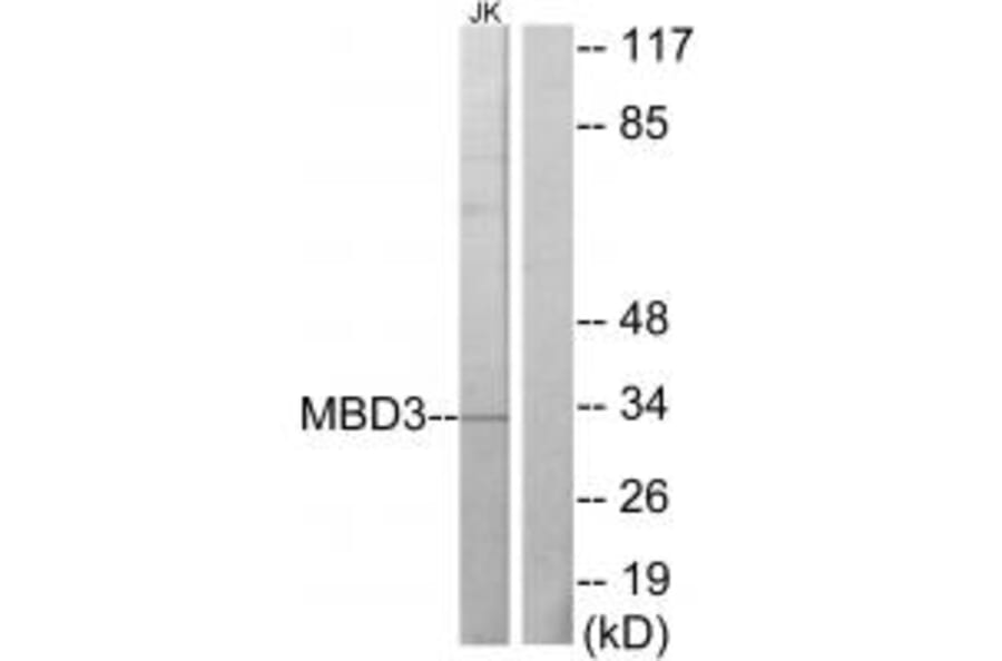 Western blot - MBD3 Antibody from Signalway Antibody (33640) - Antibodies.com
