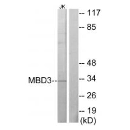 Western blot - MBD3 Antibody from Signalway Antibody (33640) - Antibodies.com
