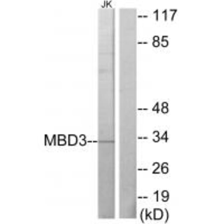 Western blot - MBD3 Antibody from Signalway Antibody (33640) - Antibodies.com