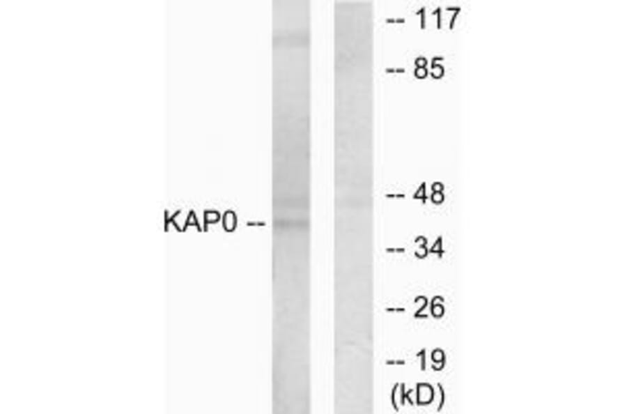 Western blot - KAP0 Antibody from Signalway Antibody (33669) - Antibodies.com