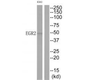 Western blot - EGR2 Antibody from Signalway Antibody (33670) - Antibodies.com