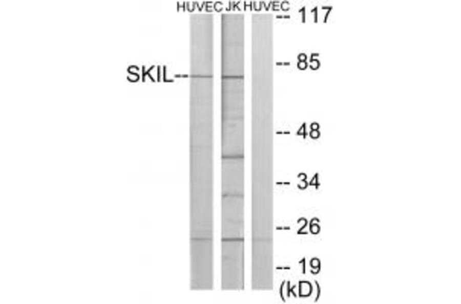 Western blot - SKIL Antibody from Signalway Antibody (33674) - Antibodies.com