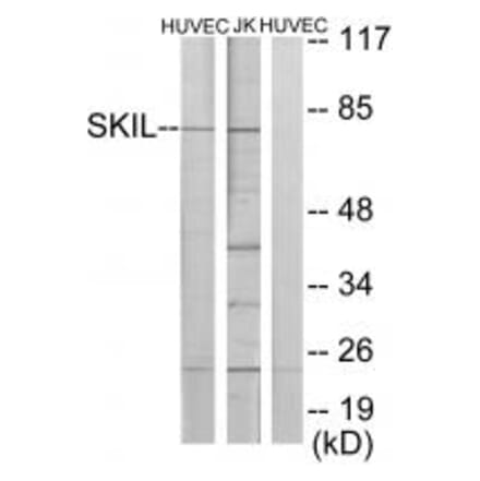 Western blot - SKIL Antibody from Signalway Antibody (33674) - Antibodies.com