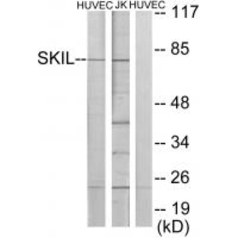 Western blot - SKIL Antibody from Signalway Antibody (33674) - Antibodies.com