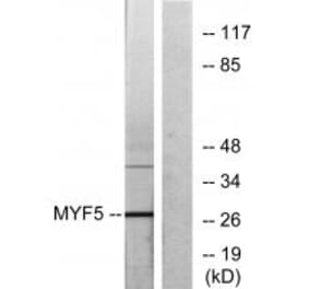 Western blot - MYF5 Antibody from Signalway Antibody (33677) - Antibodies.com