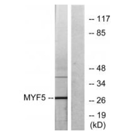 Western blot - MYF5 Antibody from Signalway Antibody (33677) - Antibodies.com