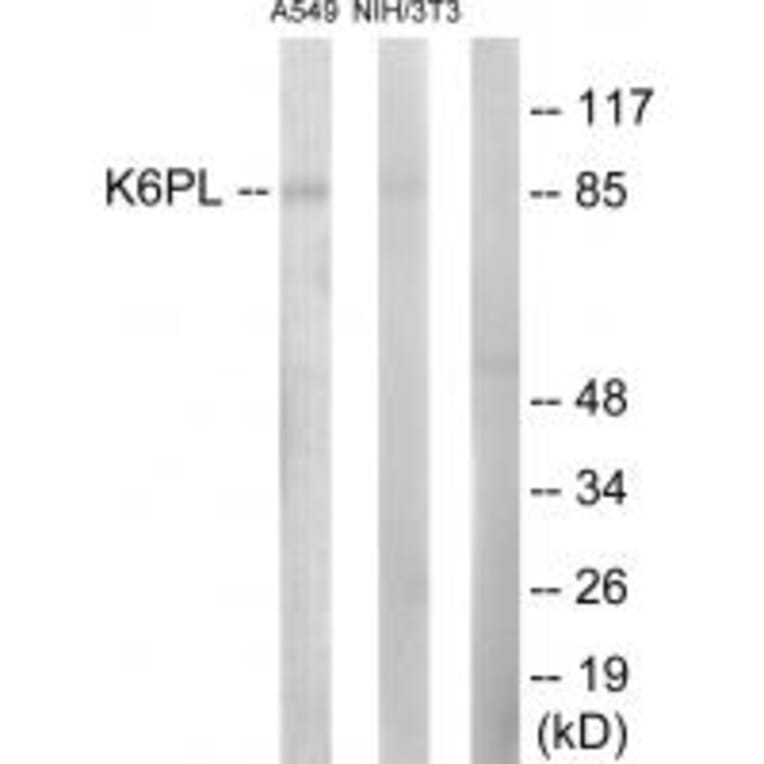 Western blot - K6PL Antibody from Signalway Antibody (33698) - Antibodies.com