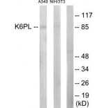Western blot - K6PL Antibody from Signalway Antibody (33698) - Antibodies.com