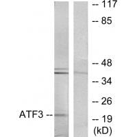 Western blot analysis of extracts from RAW264.7 cells, using ATF3 antibody #33704.