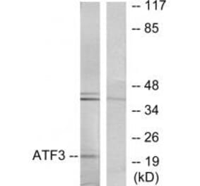 Western blot - ATF3 Antibody from Signalway Antibody (33704) - Antibodies.com