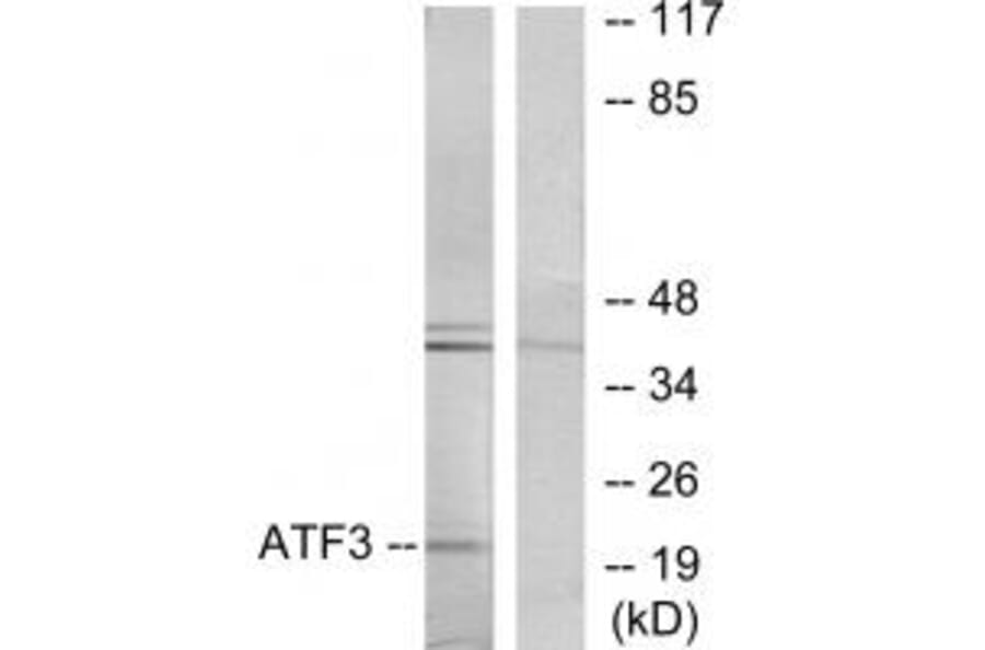 Western blot - ATF3 Antibody from Signalway Antibody (33704) - Antibodies.com