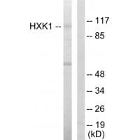 Western blot analysis of extracts from HeLa cells, using HXK1 antibody #33706.