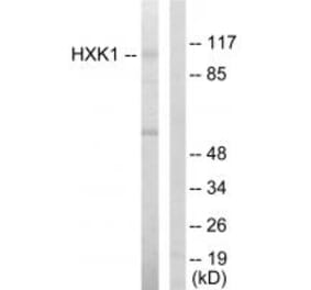 Western blot - HXK1 Antibody from Signalway Antibody (33706) - Antibodies.com