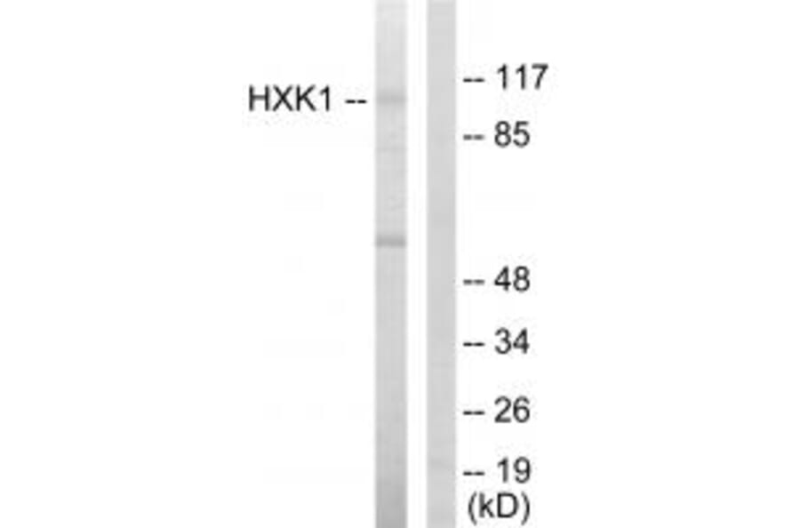 Western blot - HXK1 Antibody from Signalway Antibody (33706) - Antibodies.com