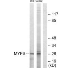 Western blot - MYF6 Antibody from Signalway Antibody (33719) - Antibodies.com