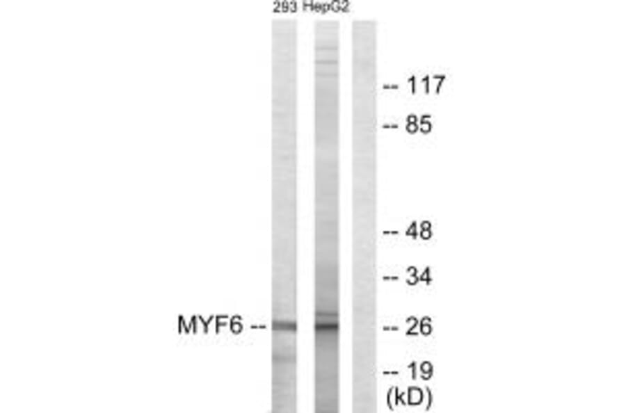 Western blot - MYF6 Antibody from Signalway Antibody (33719) - Antibodies.com