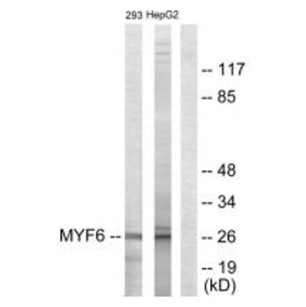 Western blot - MYF6 Antibody from Signalway Antibody (33719) - Antibodies.com