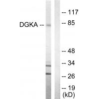 Western blot analysis of extracts from Jurkat cells, using DGKA antibody #33723.